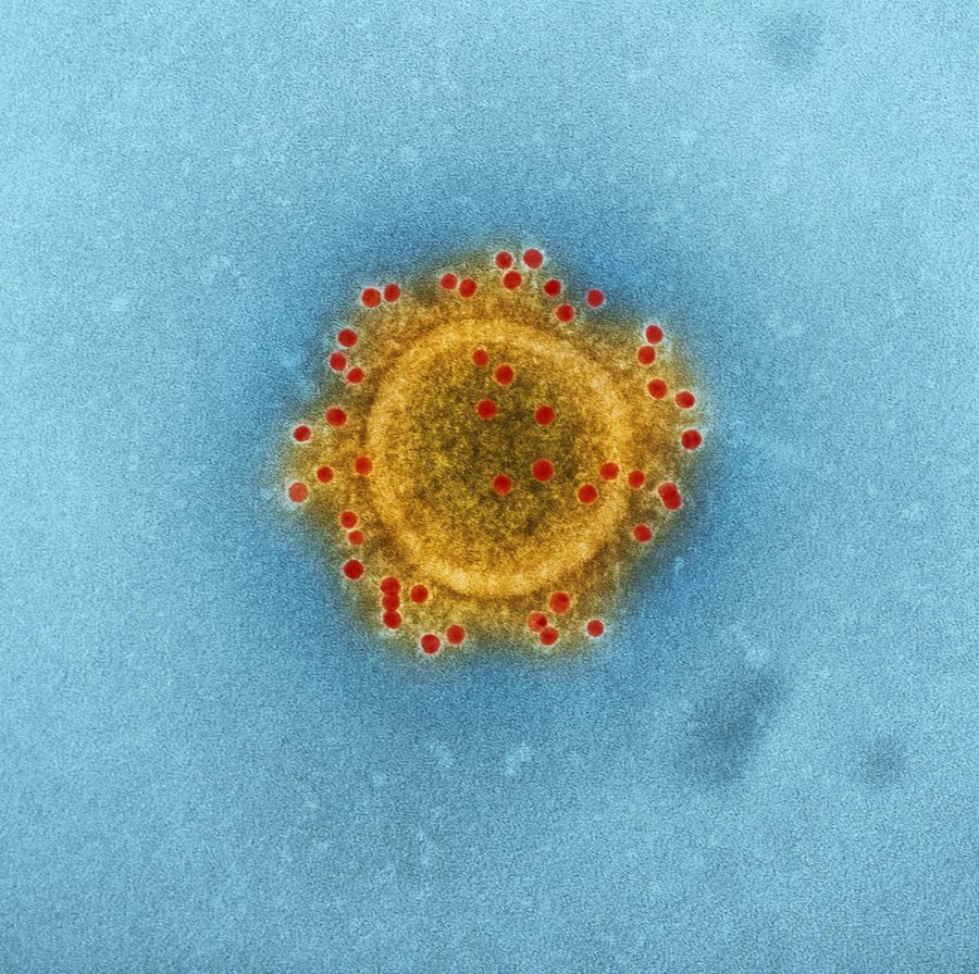 Coronavirus: what you really need to know